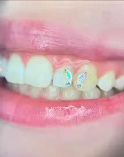 Close-up of a crystal tooth gem on a front tooth