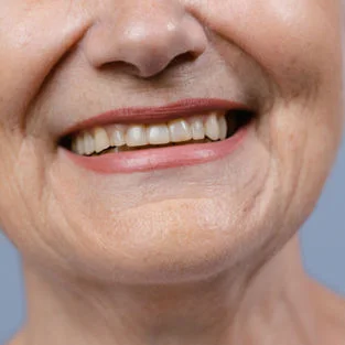 Close-up of a smile