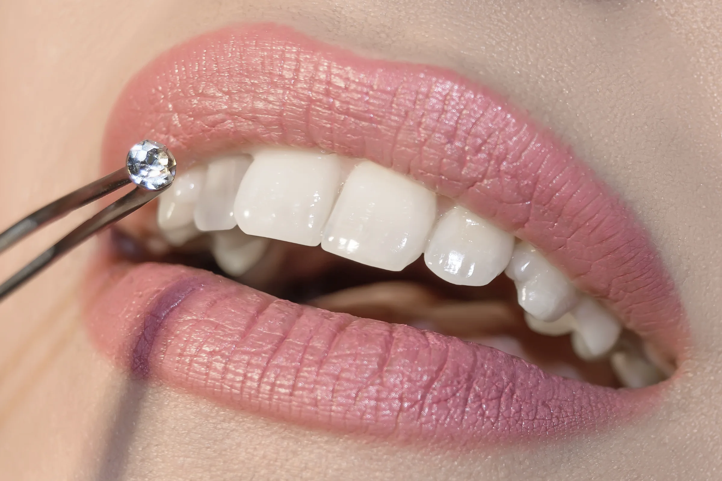 Crystal tooth gem held in tweezers beside a bright white smile