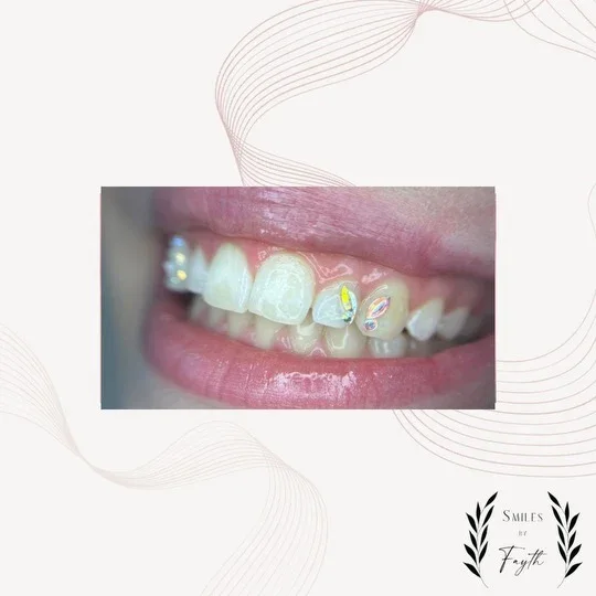 Tooth gem result from Smiles By Fayth