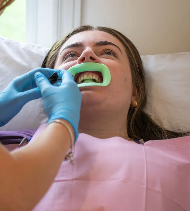 Whitening gel being applied with gum protection in place